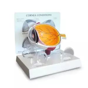 -GPI Anatomicals 인체모형 단면 안구모형 각막 G278