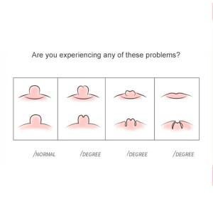 휴대용 여성 젖꼭지 교정기 흡입 펌프 풀러 마사지기 산모 건강 관리 수유 보조