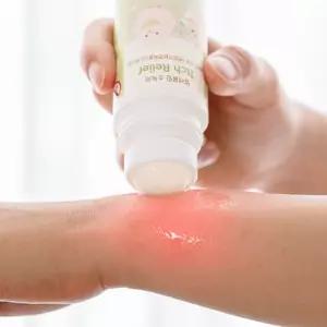 아가드 아기 벌레물림 소독제 바르는 모기약 쿨링 에이드프로 벤잘코늄염화물 오렌지향 50ml 볼타입