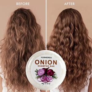 비건 양파 샴푸바 천연 헤어 케어 비듬 방지 유분 조절 갈라진 모발 복구 건조하고 곱슬거리는 모발 영양 공급 두피 솔리드 샴푸 비누