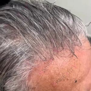 가벼운 80% 밀도 0.02mm 초박형 스킨 투명 헤어라인 화이트 실버 그레이 블랙 1B65 1B80 남성용 부분 가발 블론드 보철 시스템