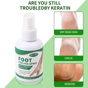 TEMU 발 뒷꿈치 보습크림 발 뒷꿈치 각질제거 스프레이 발각질 연화제 발뒤꿈치 각질제거 우레아 스프레이