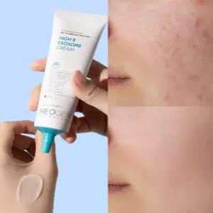 네오젠 피부과 입점 하이알 엑소좀 크림 40ml 재생크림 탄력진정기미,멜라닌, 주름 피부 부스팅