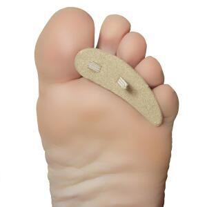 STEINS HAMMER TOE 크레스트 쿠션 및 버트리스 왼쪽, 망치 큰 3개(1팩) 패드는 베이지, 감소, 발가락으로 인한 압력 굳은살과