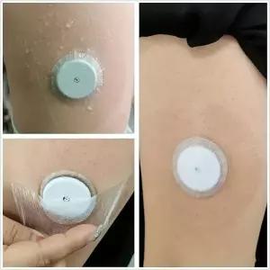 20개 프리스타일 리브레 센서 커버 2용 라텍스 프리 프리컷 C 테이프 방수 강력한 접착력 장기 사용
