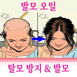 모발 관리 에센셜 오일, 건강한 모발, 2세대 M자형, 두피 보호, 깊숙이 침투, 두피 영양 강화 에센셜 오일.