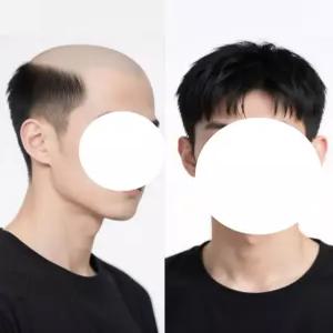 풀헤드 가발 남성 인모 메시 용 신축 자연스러운 통 상투 남성용 스타일 헤드