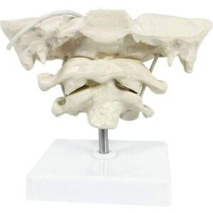 폐 모형 학교 교육용 Training 폐모형 후두골 교구 및 Medical 모델 경추 Axis A 아틀라스 후두엽 PVC Aident hing 인간 소재 컬러 with