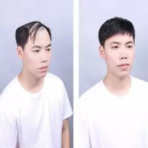 헤어 남자 네추럴 스타일 윗머리 가발 풍성한