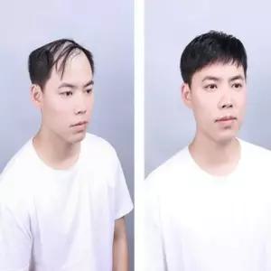 [룽스_62]가발 엄마정수리가발 풍성한 남성 헤어 스타일