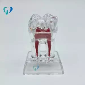 치아 모형 데모 인체 구강 실습 스케일링 치과 치위생 모델 연습 틀니 교육 교정