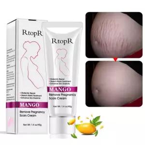 망고 스트레치 마크와 크림 임신을 위한 제거 주름을 벨리 비만 지방 보습 40g