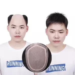 인모 남자 두피 붙이는 가발 원형 남성형 가벼운 가발 WFNCRHS