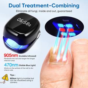 손발톱 무좀 레이저 치료기 LED 905nm 적외선 470nm 청색광 손발톱 항진균 세척 도구