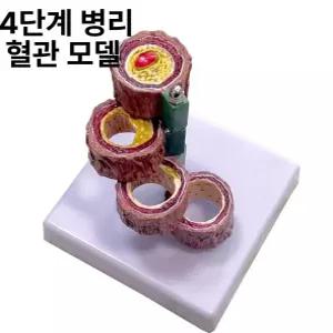 심혈관모형 동맥경화혈관모형 해부학 병원 교육용 혈전 모델 고지혈증 인체