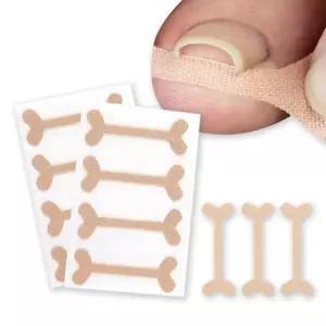 발톱밴드 파고드는 발톱 테이프 밴드 48매 발가락보호대 발가라보호 (WC4D591)