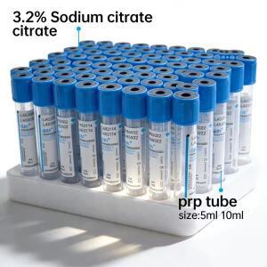 의대생 5ml/10ml 일회용 진공 혈액 채취 튜브 3.2% 구연산나트륨 PT 멸균 검사 prp 실험실 소모품