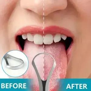 2pcs 성인 혀 코팅 스크레이퍼 휴대용 및 재사용 가능한 스테인레스 스틸 신선한 호흡 클리너 구강 관리