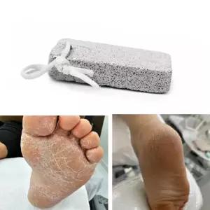 썬코 발뒤꿈치 뒷꿈치 굳은살 복숭아뼈 각질밀이 돌 각질제거