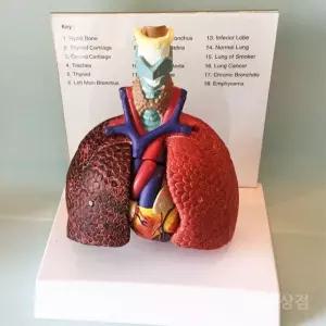 과학폐모형 병원 교육용 진료실 호흡기 인체 호흡기관 해부도 구조 해부학 보건소
