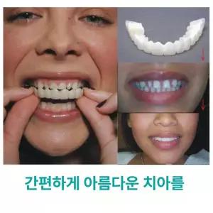 치아커버 앞니 식신기 항목 임시치아 단일 식사용
