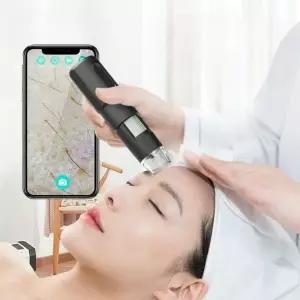 분석기 두피현미경 고화질 헤어 검사 모발 모낭 확대경 관리 진단 탈모 케어