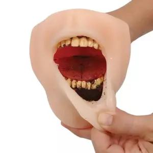 모형 흡연으로인한 치아부식모형 MR DIP LIP