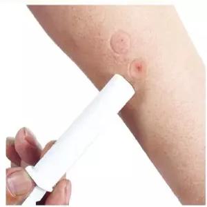 파인버 2PK 모기벌 쏘임 벌레 물린 부위 키트 흡입 도구 안전 용품 하이킹 배낭 캠핑을 위한 천연 응급
