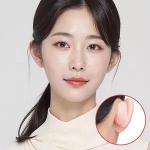 귀필러 미용 아무 테이프 소두 얼굴작아보 귀모양성형