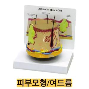 -미국 GPI 인체모형 확대된 피부단면모형 여드름 G375