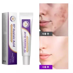 아-젤- 라익애씨드 15% 함유 피부 케어 크림 | 모공 관리 여드름 흔적 케어 | 저자극 보습 크림, 20g