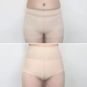 STK113 아영 복부압박스타킹 압박스타킹 보 몸매 보정