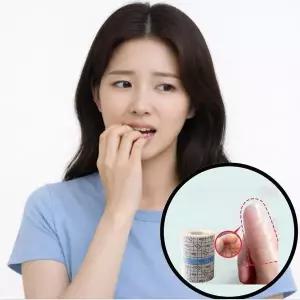 [셀러허브]손톱 뜯기 습관 테이프 물어뜯기 예방 밴드 방지 굳은살 버릇방지 (S46604450)