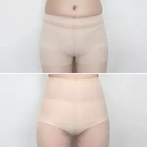 STK113 압박스타킹 복부압박스타킹 보정스타킹