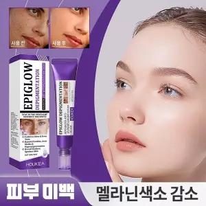 미백 및 기미제거 전용크림 - 기미/주근깨/ 검버섯/멜라닌 침전물을 효과적으로 제거 민감성 피부 사용 가