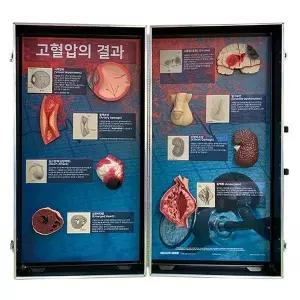 HEALTH EDCO  고혈압의 결과모형 78927