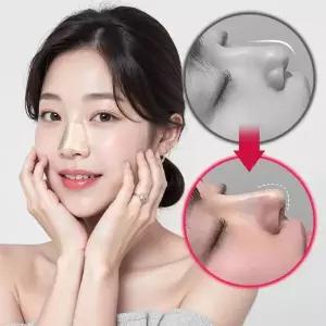 코높이 기구 코모양 잡아주는 리프팅 줄이기 콧볼 밴드 리프팅 성형 홈케어뷰티 기구 는패치 코