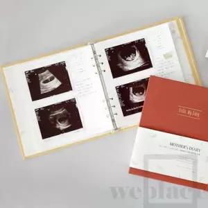 초음파앨범 리필지 (30P) 임산부다이어리 태아초음파앨범 태교수첩