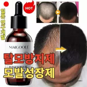 탈모 예방 영양제 탈모 증상 완화 남녀 공용 순하고 자극 없음 탈모 방지 헤어 에센스 모발 성장 촉진 두피