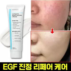 고함량 EGF 재생크림 진정 시카 크림 주름개선 피부 붉은기 보습 병풀 재생 크림 피부장벽강화 PDRN 콜라겐