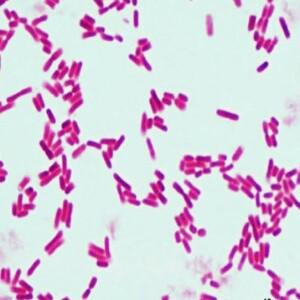 대장균슬라이드표본(Escherichia Coli) EDU-22617 / 과학체험학습교구