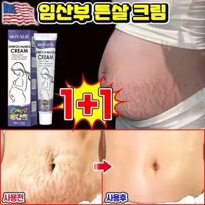 [빠른효과] 1/1+1/2+2 임산부 튼살크림 오래된 튼살제거크림 산후 임신주름 비만주름 청소년 성장주름 개선