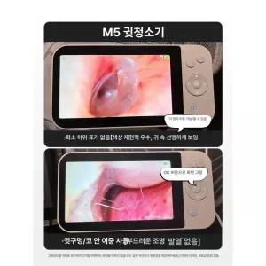 셀프 귀내시경 카메라 귀지제거 귀지 후비개 귓속 내시경
