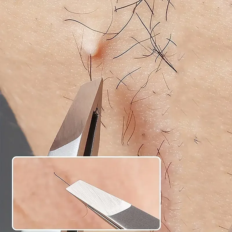 Ouriner 눈썹 족집게 세트 4 Pcs 스테인레스 스틸 눈썹 집게 전문 미용 도구 세트 안쪽으로 성장하는 얼굴 털