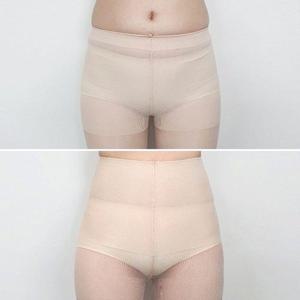 STK113 복부압박스타킹 압박스타킹 보정스타킹