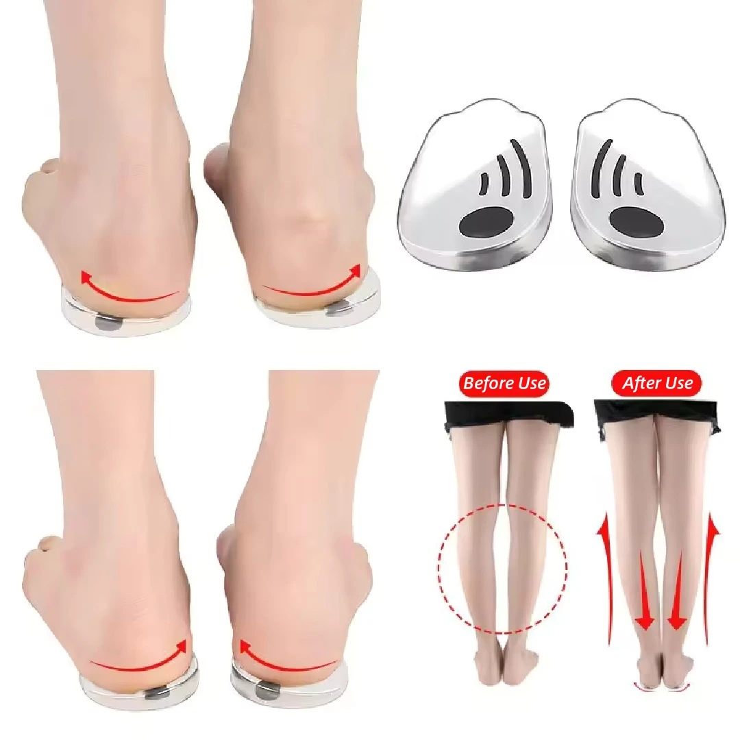 발 O/X 다리 유형을위한 실리콘 정형외과 깔창 Valgus Varus 교정 족저근막염 젤 깔창 자석 마사지 발 관리