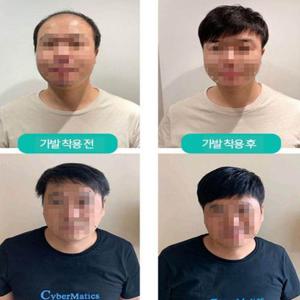 남성용 자연스러운 부분가발 부족한 머리숱