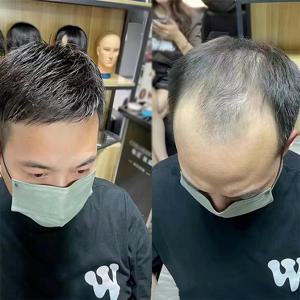 남성 정수리가발 블랙 헤어패치 부분 탈모 커버 맞춤 남성가발 H725