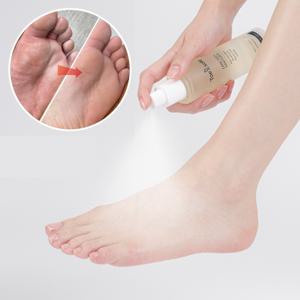 [피부과 전문의 개발]새니닥 토앤솔 풋케어 스프레이 100ml 각질 보습 항균 임상시험 완료