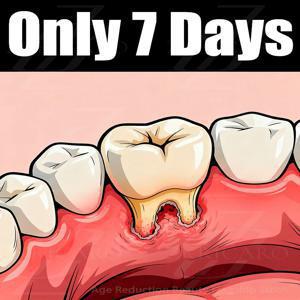 Eᴀsɪʟʏ ʀᴇɢᴇɴᴇʀᴀᴛᴇ ɢᴜᴍs ᴀɴᴅ ᴄᴏᴠᴇʀ ᴛᴇᴇᴛʜ ɪɴ 7 ᴅᴀʏs